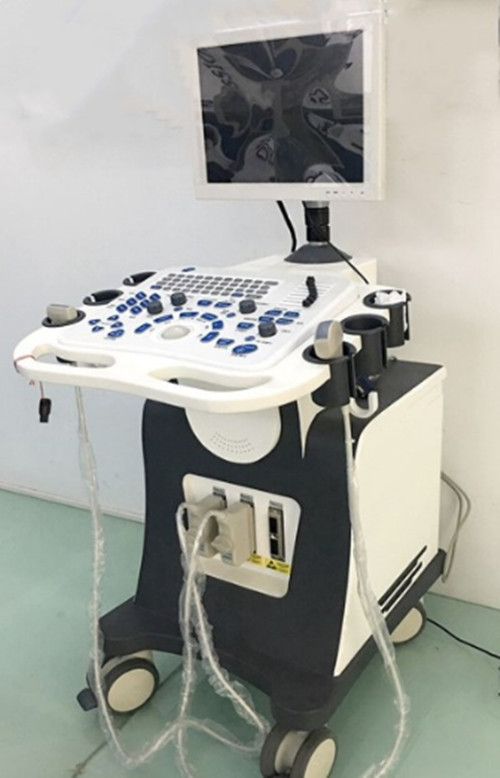 3D Color Digital Trolley Ultrasound Diagnosis System