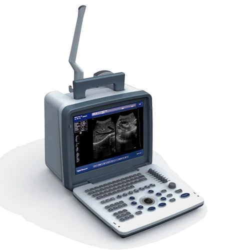 Black and white ultrasound scanner