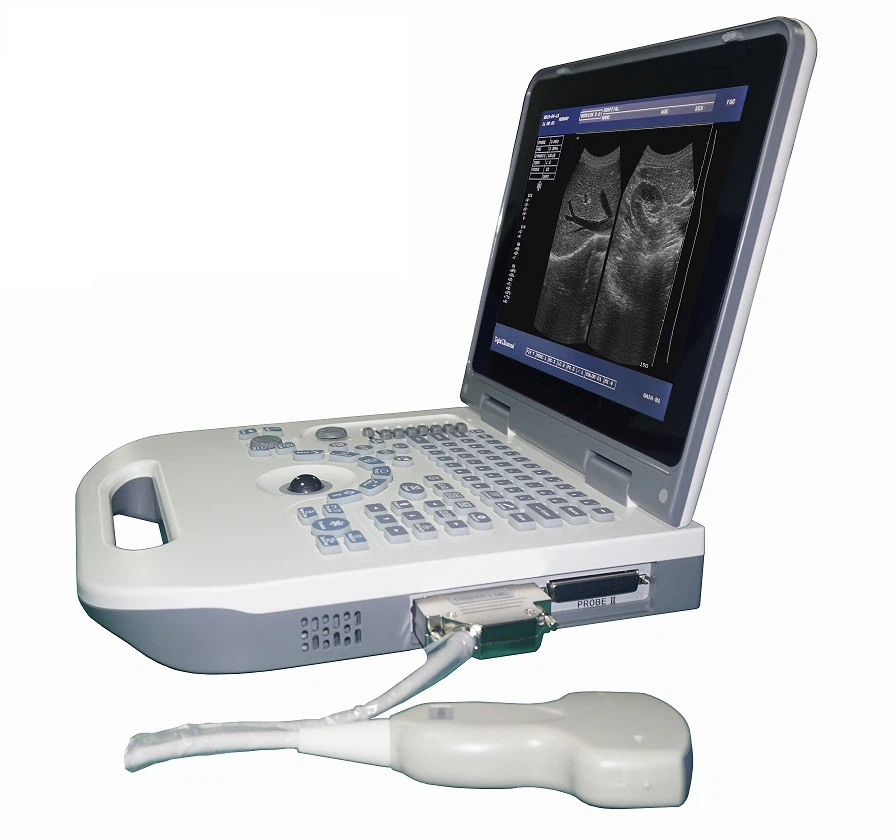 BW Ultrasound Machine