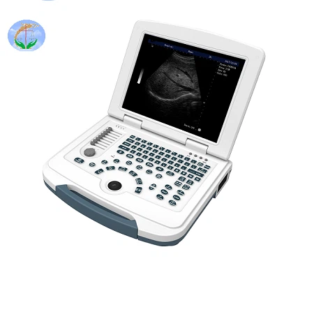 YJ-U580 ultrasound YJ-U580 ultrasound