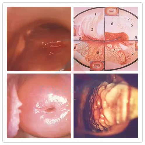 Digital Electronic Colposcope