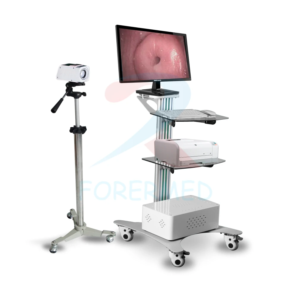 Digital Electronic Colposcope Digital Electronic Colposcope