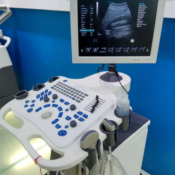 3D Color Digital Trolley Ultrasound Diagnosis System