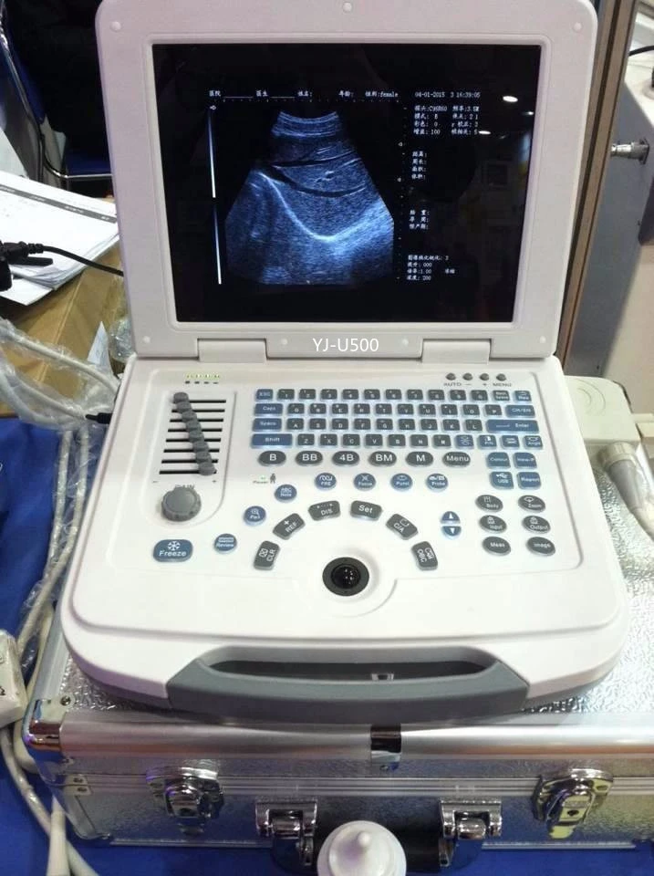 B/W SGS Notebook Ultrasound Diagnosis System B/W SGS Notebook Ultrasound Diagnosis System