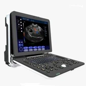 Ultrazvukový diagnostický systém notebooku