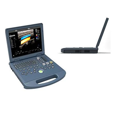 Laptop Color Doppler Ultrasound Machine