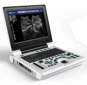 Přenosný ultrazvukový diagnostický systém